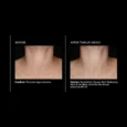 Perfecting Neck & Décolleté