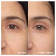 Retinol Eye Renewal