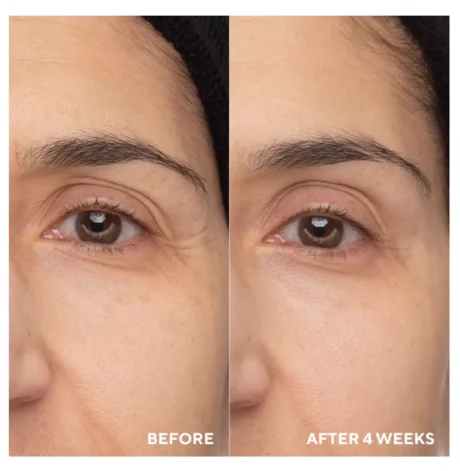 Retinol-Eye-Renewal-BA