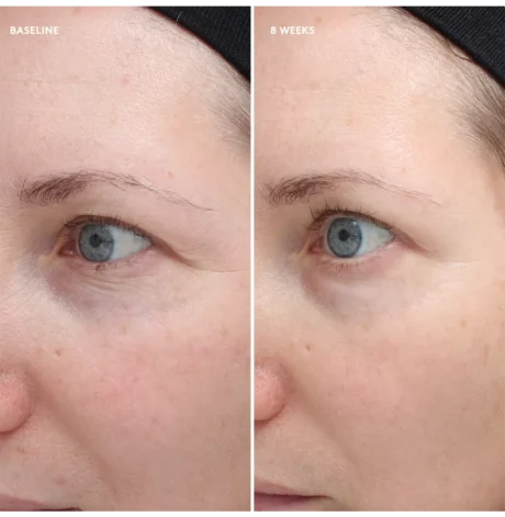 Total-Eye-Firm-Repair-Cream-Before-After