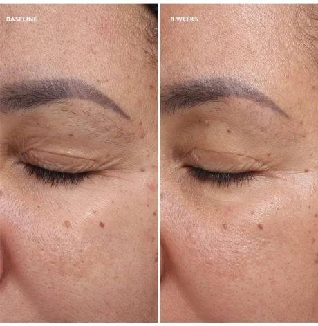 Total-Eye-Firm-Repair-Cream-Before-After2